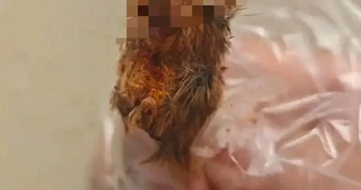 吓吐了！吃一半才发现异物是老鼠头？市监部门紧急调查回应