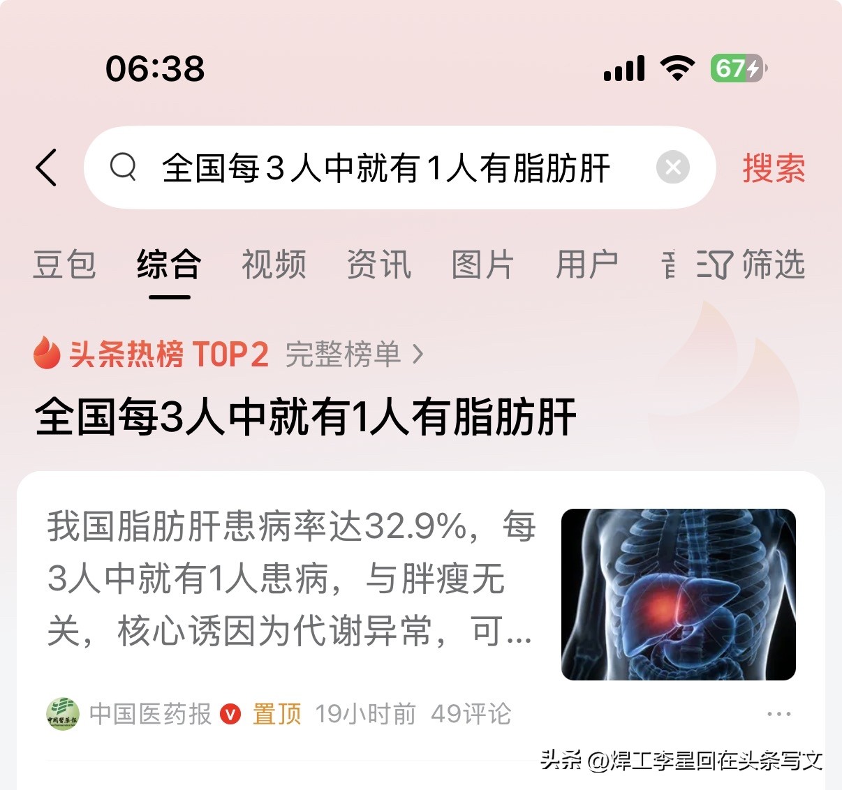 男的一到岁数不是脂肪肝就是肾结石，很多新闻只讲数据吓人，不讲怎么处理...