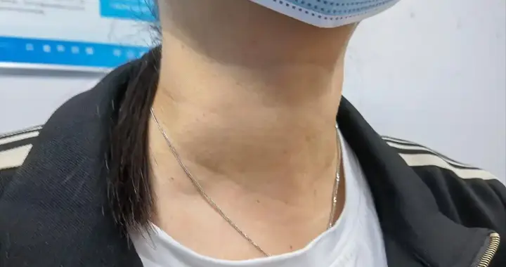 甲状腺癌者最后都是怎么离世的？医生叹气：很多身体早有5个预兆