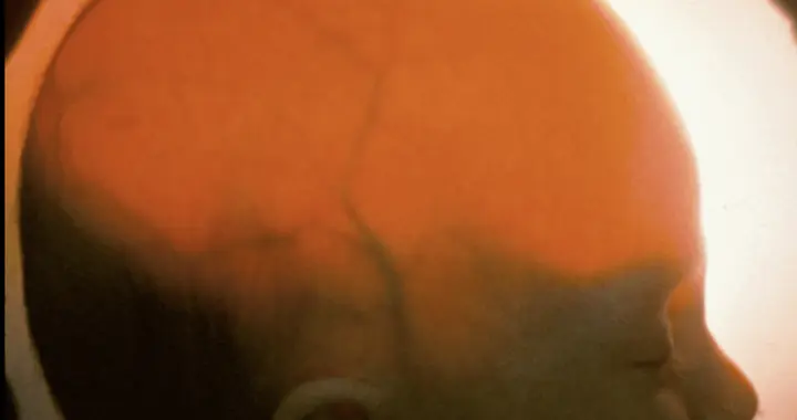 我们追踪了一家做器官培育的隐秘公司两年，发现它真正想做的是无脑人类克隆体