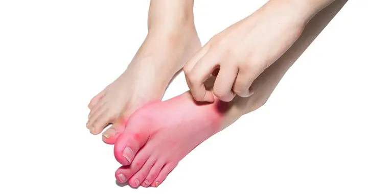 疾病来前，脚先知？提醒：快看看你的脚，有这5个症状别忽视