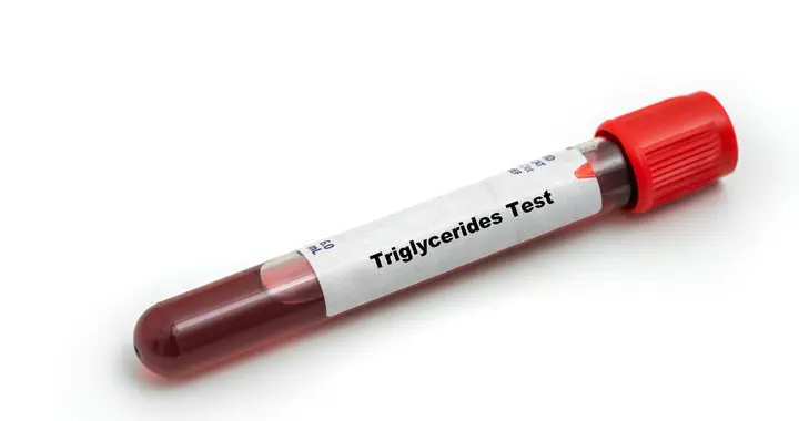 甘油三酯高吃非诺贝特，这七个问题一定要知道！