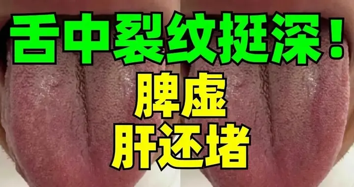 气虚阴不足、脾虚肝还堵？