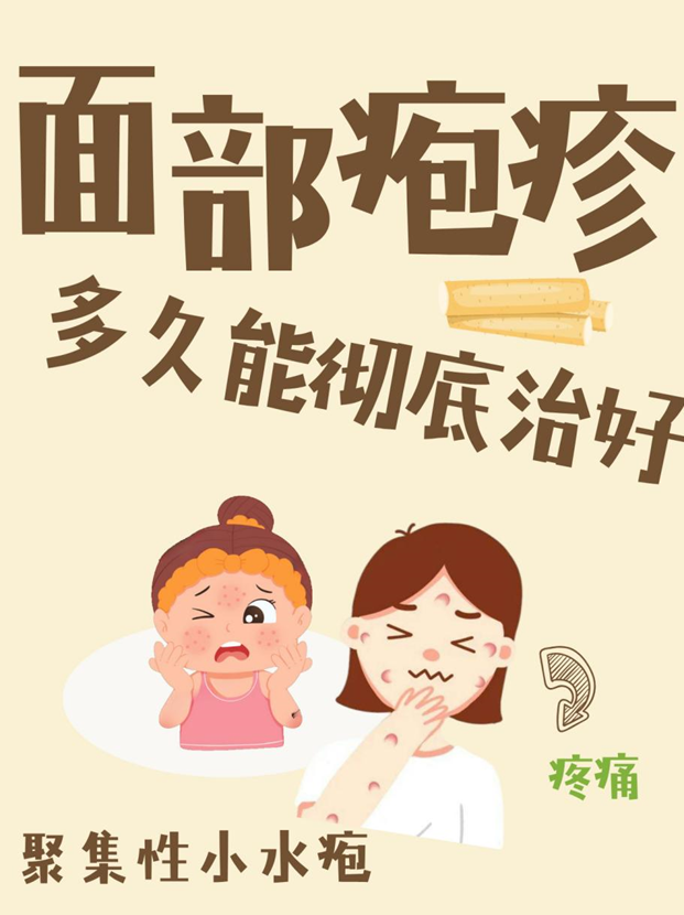 面部疱疹多久能彻底治好