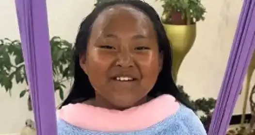 无知！女儿被晒成酱油色家长还在炫耀，医生网友评论区紧急提醒