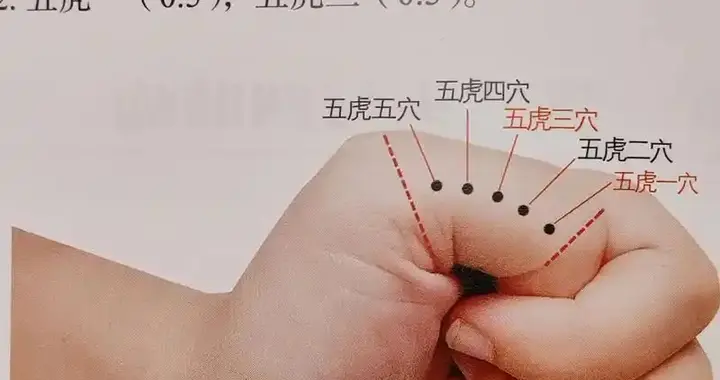 探秘董氏奇穴手部穴位：传统医学的瑰宝