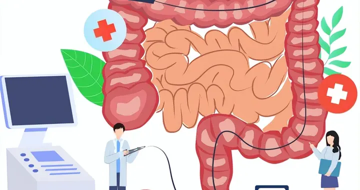 得了肠息肉别慌！切与不切看这里