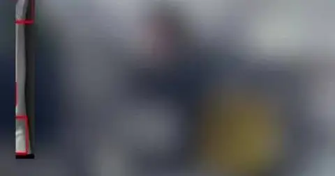 9岁女孩确诊性早熟，皆是“宠”出来的