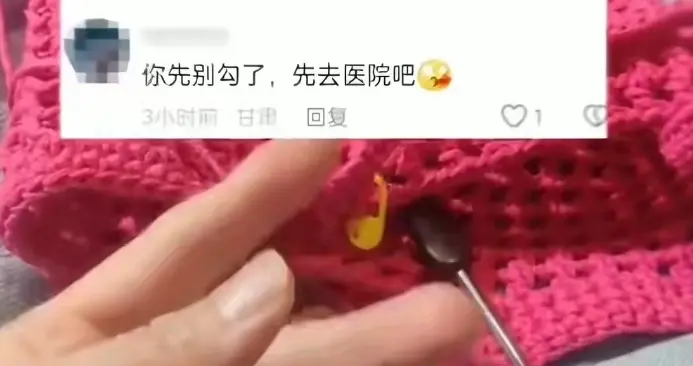 女子晒手指被网友劝就医，一查真有问题！这些身体信号别大意
