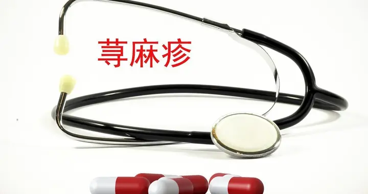 潜阳封髓丹调理慢性荨麻疹