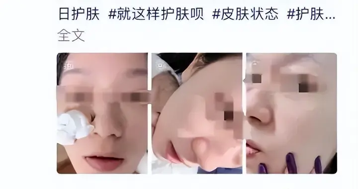 “以油养肤” 全网爆火：是护肤神器还是智商税？