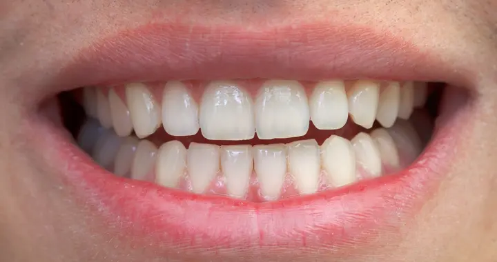 种牙与拔牙到底谁更痛？