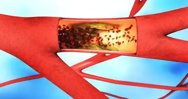 抖腿不仅是“坏习惯”，更是能部分抵消久坐危害的微型健康助攻