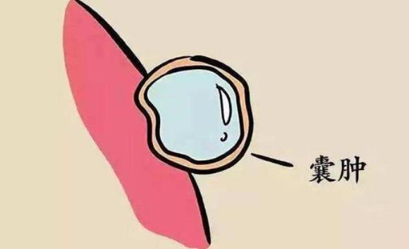 一个专方，堪称洗涤剂，清全身痰瘀，通一身气血，破开囊肿