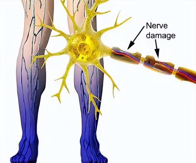 甲钴胺可以长期服用吗，需要注意什么？