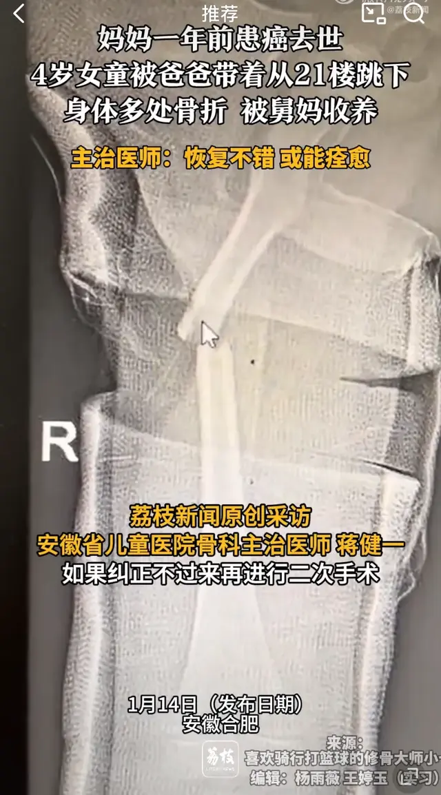 4岁女童被爸爸带着跳楼捡回一命，多处骨折被舅妈收养感动无数人