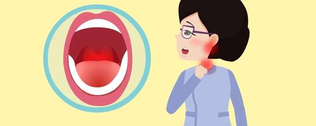 耳朵痛+喉部痛，竟是舌咽神经痛惹的祸