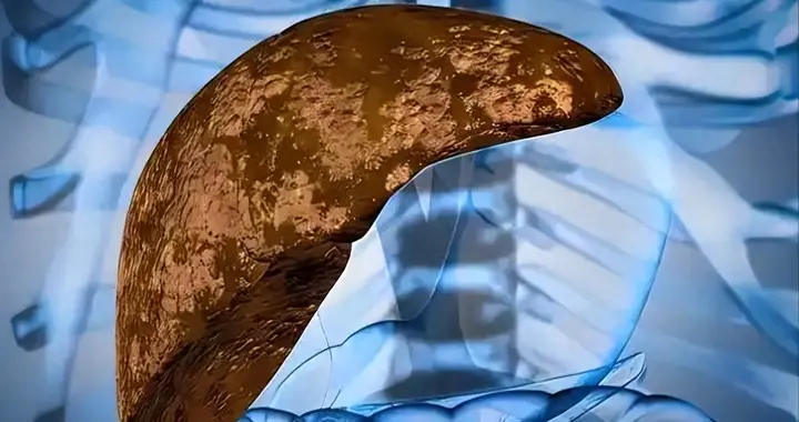 轻断食再次封神！复旦大学研究证实，让肝脏脂肪在5个月内少20.5%