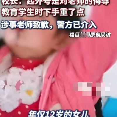 菌菌的渔：起外号被打？六年级女生被老师扇