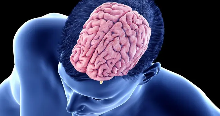 体检报告出现腔隙灶，就是脑梗、要中风？多数中老年人都踩坑？