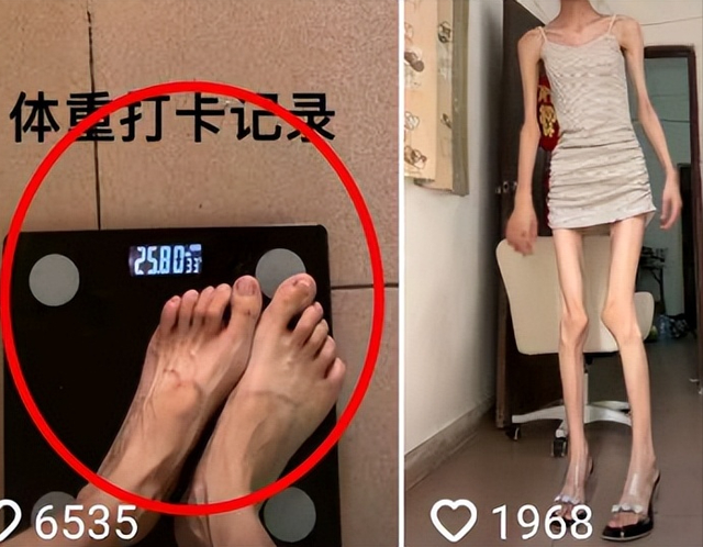 热议！网红“婷子宝宝”身高160体重51斤，网友：赶紧去看医生！