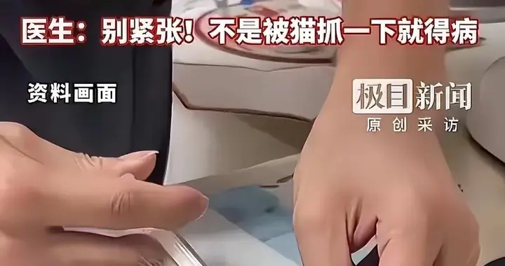 武汉男孩被自家猫轻抓一把腋窝长乒乓球包 是猫抓病不是狂犬病！
