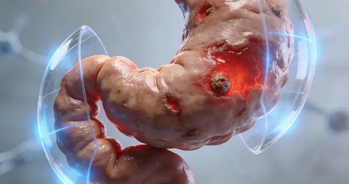 胃病的“病根儿”在于胃黏膜损伤？3个修复方法，胃病或不攻自破