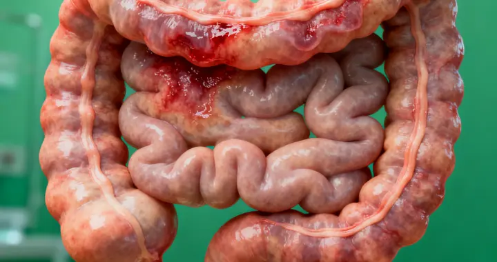 送你一个中成药：对肠易激综合征，腹泻、腹痛都能调理，一文解析