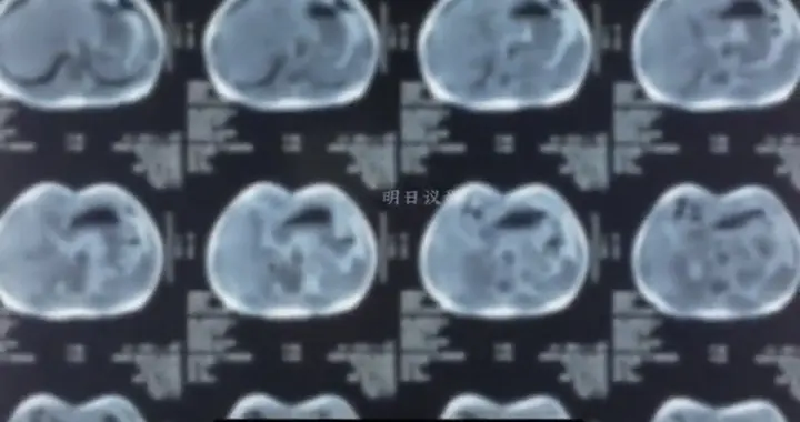 国产相控阵CT破垄断，千亿赛道六家企业迎风口！
