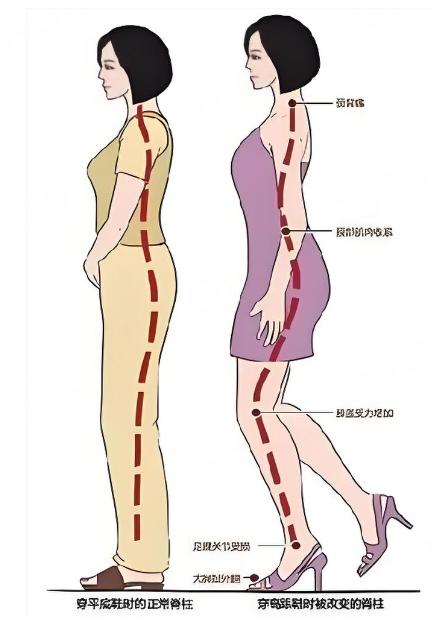 重心前倾让髌骨承压升至7-8倍，为何早期几乎无痛感？