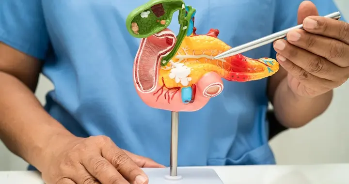 中央研究院与台大医院联合开发胰腺癌人工智能模型，力求治愈癌症