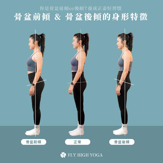 肚子鼓不是胖，是骨盆前倾惹的祸！