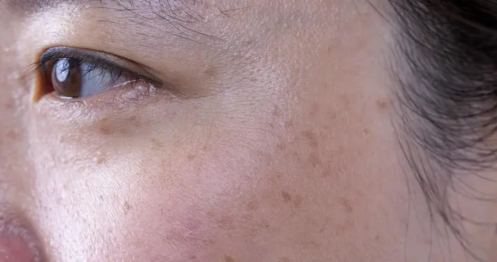 探寻皮肤病的内科病因