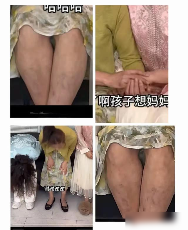 许健华直播爆单浑身是伤，老谢急诊引争议：这出认亲戏谁在走心？