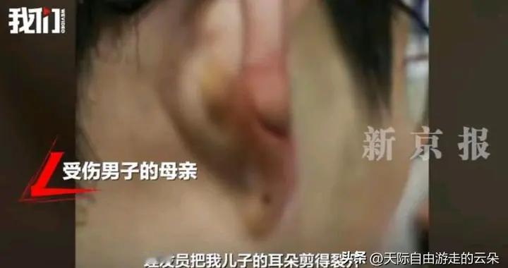 惊魂！广东男子理发耳朵被剪裂1.8厘米！店员竟称“像切菜概率”