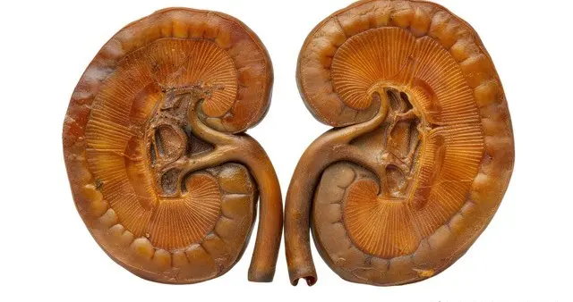 肾囊肿老让腰背痛？根源是“两不通、两不养”！教你疏通+滋养