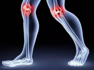菜谱|踝关节或膝关节扭伤要多久康复？能否通过健身来加速恢复？
