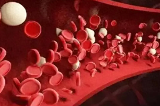 血液“稀释剂”公布，不是柠檬水，医生：平时常喝，血管或变干净