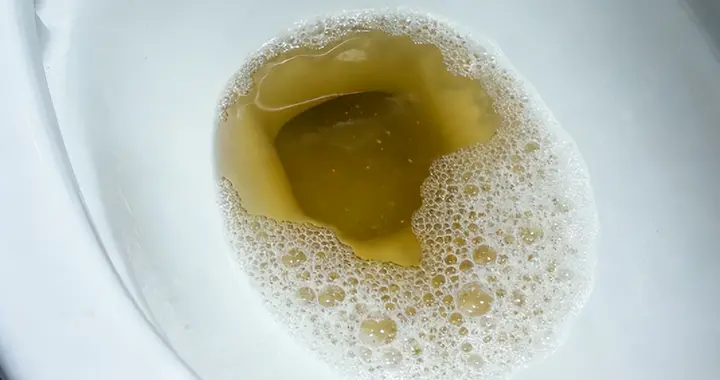 糖友出现蛋白尿后，这6个坏习惯赶紧改，否则就离尿毒症不远了