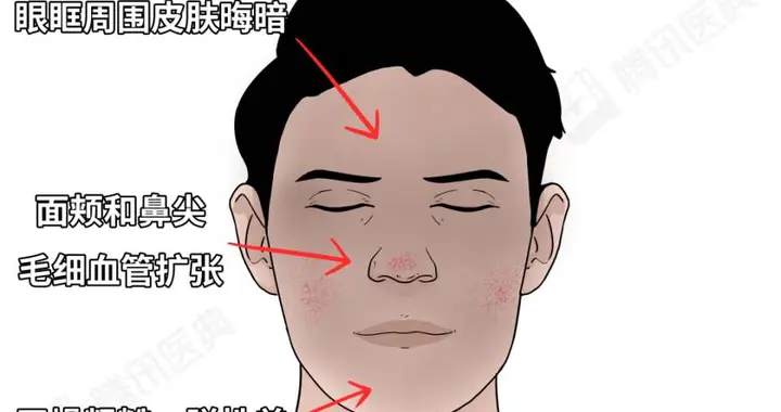 看脸识健康！这6个面部信号，千万别当成小问题！