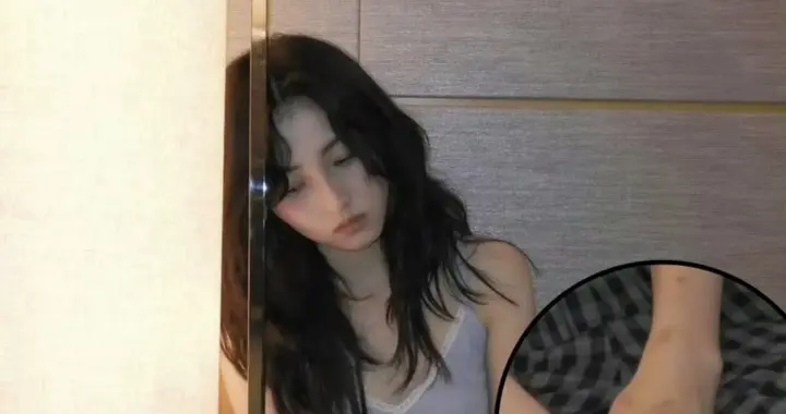 张子枫手臂伤疤上热搜，网友：妹妹这是拿命在拍戏啊！