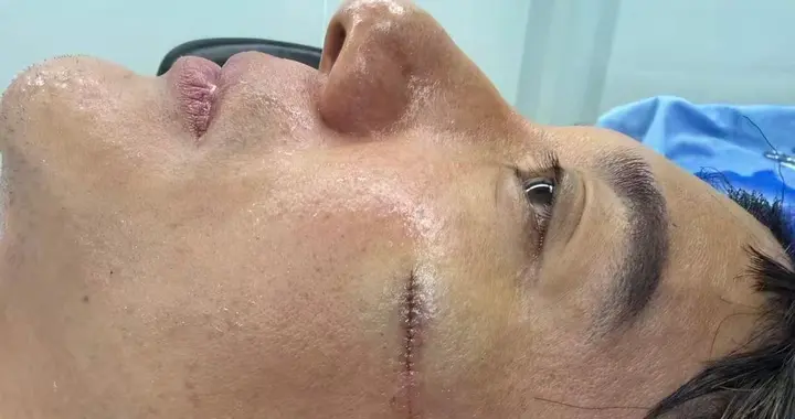 突发！王力宏意外摔倒险毁容，共缝39针！团队管理漏洞藏不住了