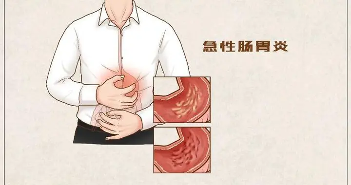 急性胃炎发作症状是什么？