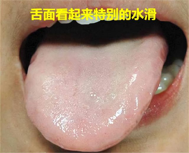 脾一虚，病就来，脾虚后参苓白术散、归脾丸、六君子丸怎么选？