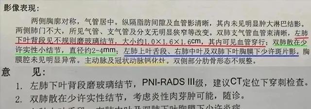 四例肺结节CT报告，有人需要手术，有人中药调理，区别在哪里？