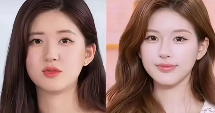 内娱第一玄人赵露思，她的脸到底整没整？