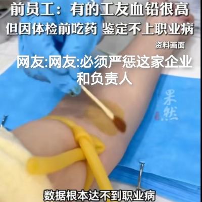 拯救爬山虎的脚：这家让员工体检前吃排铅药