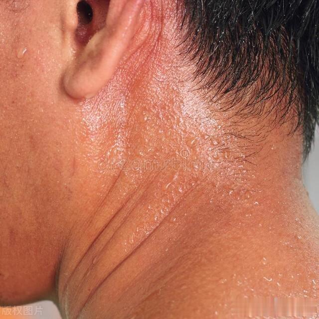 中医治汗的秘密：通常以心汗为主，以脾汗、肝汗、肺汗、肾汗为辅