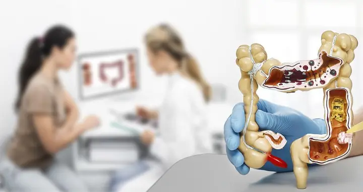 切了肠息肉，为什么医生还让我定期复查？