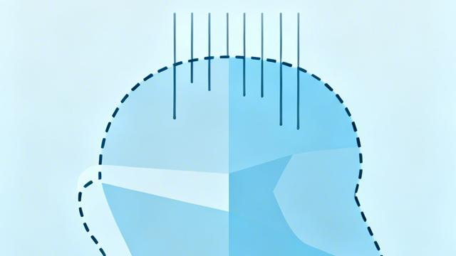 优雅小羊eX：戴假头套有哪些安全隐患 戴